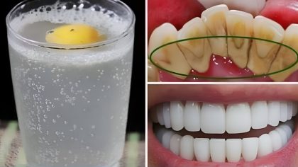 15 Secrets pour des dents éclatantes : votre sourire va rayonner