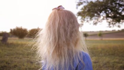 Découvrez l'incroyable transformation de cette petite fille, née avec une tumeur géante sur le visage, 2 ans après