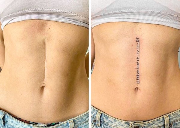 Des tatouages ​​qui aident à transformer vos cicatrices en quelque chose de beau