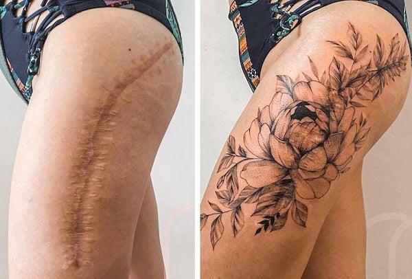 Des tatouages ​​qui aident à transformer vos cicatrices en quelque chose de beau