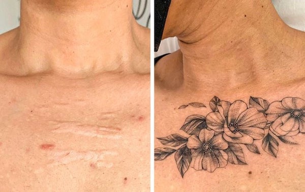 Des tatouages ​​qui aident à transformer vos cicatrices en quelque chose de beau