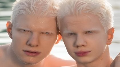 L'étonnante mère de ces frères albinos : une famille pas comme les autres