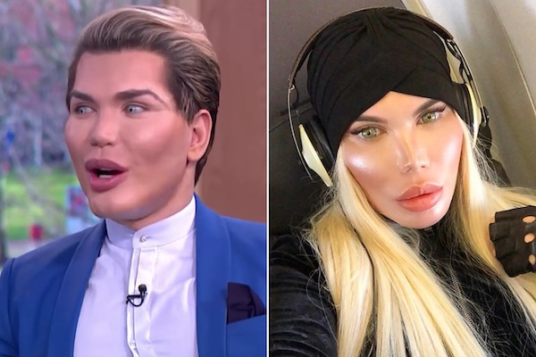 Rodrigo Alves : découvrez la transformation du "Ken humain" en Barbie