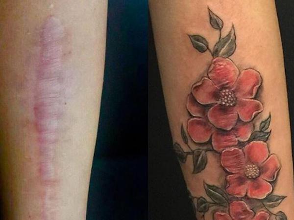 Des tatouages ​​qui aident à transformer vos cicatrices en quelque chose de beau