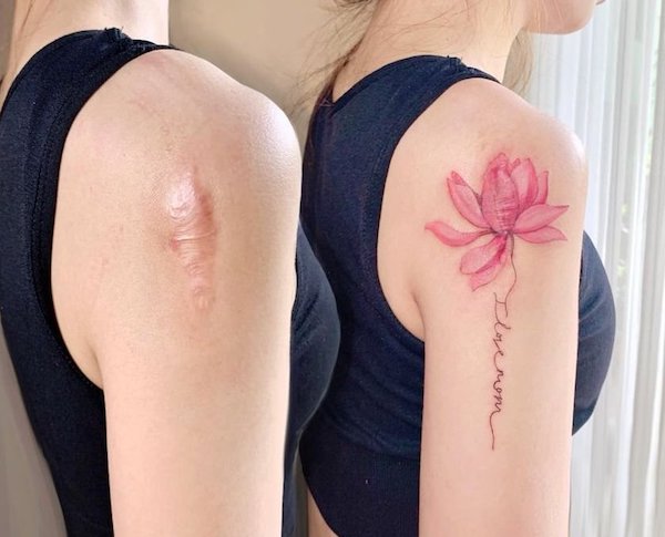 Des tatouages ​​qui aident à transformer vos cicatrices en quelque chose de beau