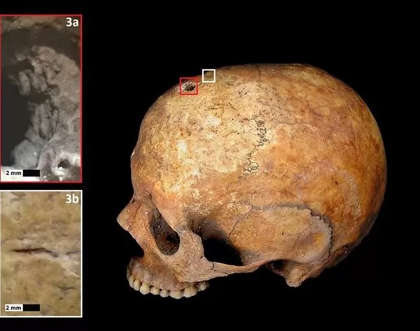 L'incroyable mystère d'un squelette vieux de 1.700 ans ayant accouché dans un cercueil : un phénomène qui suscite l'effroi