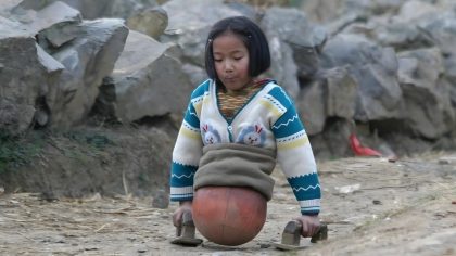 Voici à quoi ressemble la "fille ballon" abandonnée. Aujourd'hui, elle est millionnaire et belle