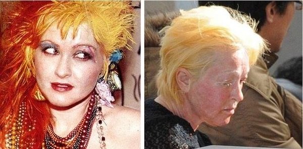 Cyndi Lauper célèbre ses 70 ans : découvrez la maladie qui l'affecte