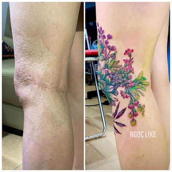 Les tatouages ​​de ce tatoueur transforment les cicatrices en symboles de confiance