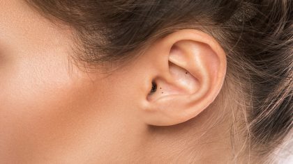 Vidéo : points noirs sur l'oreille