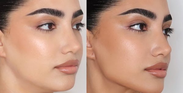 "Jawline Contouring" : ce soin pour affiner le visage connaît un véritable succès depuis le confinement